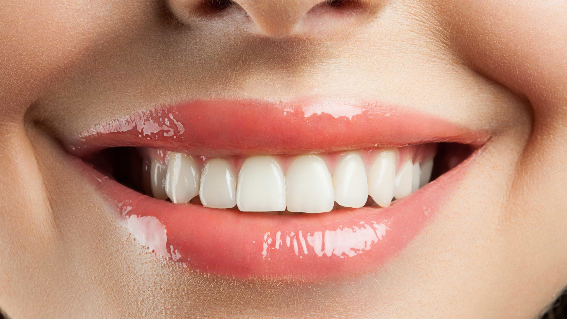 5 mitos e verdades sobre a gengivite