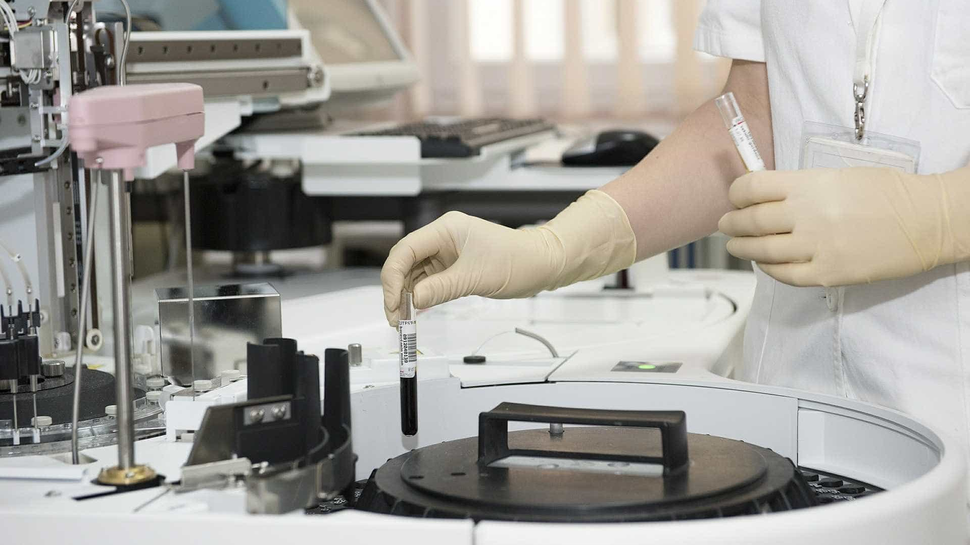 'Urina preta' pode ter origem em vírus
que gerou surto na Europa