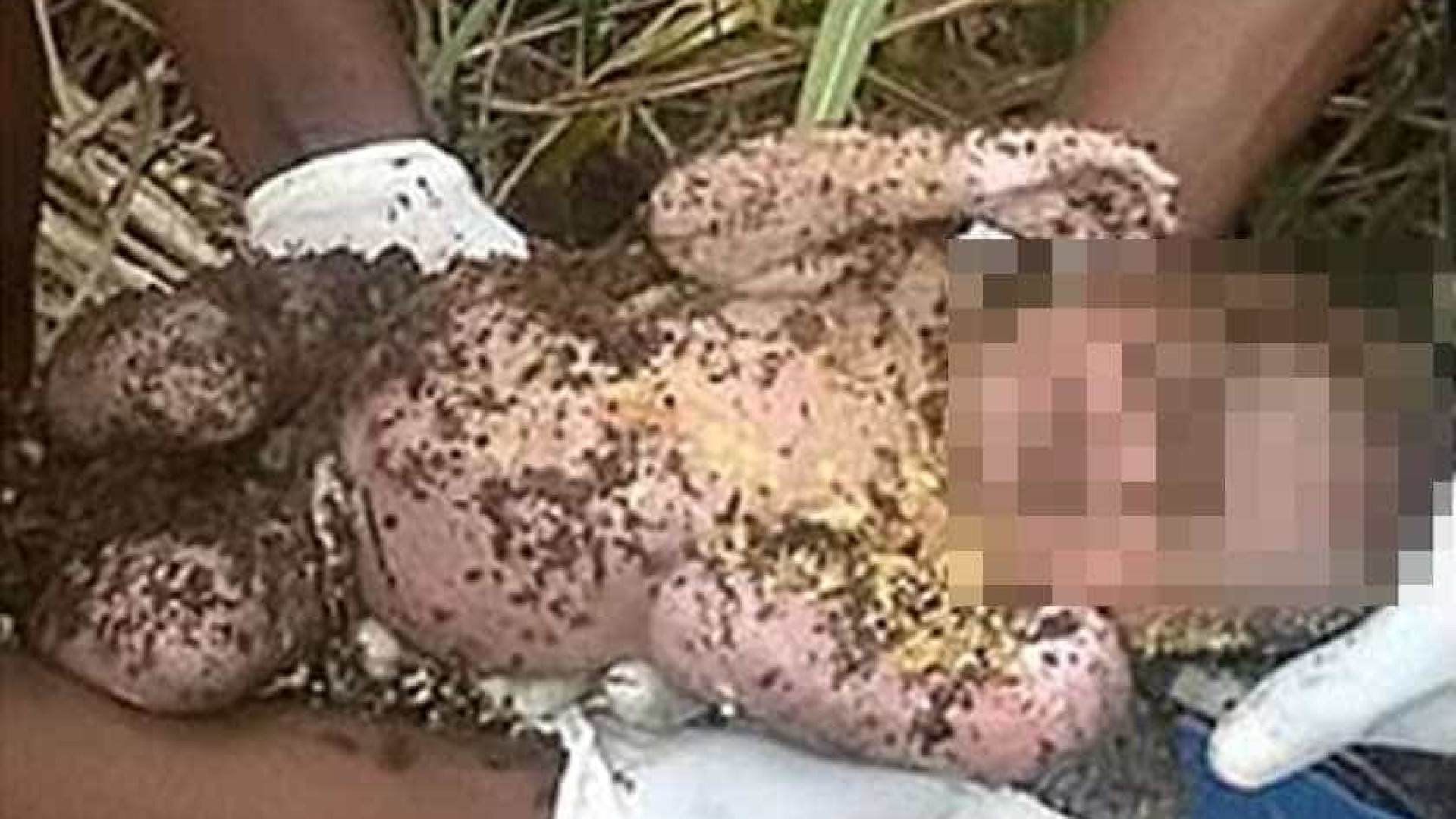 Bebê é encontrado vivo após passar três dias enterrado