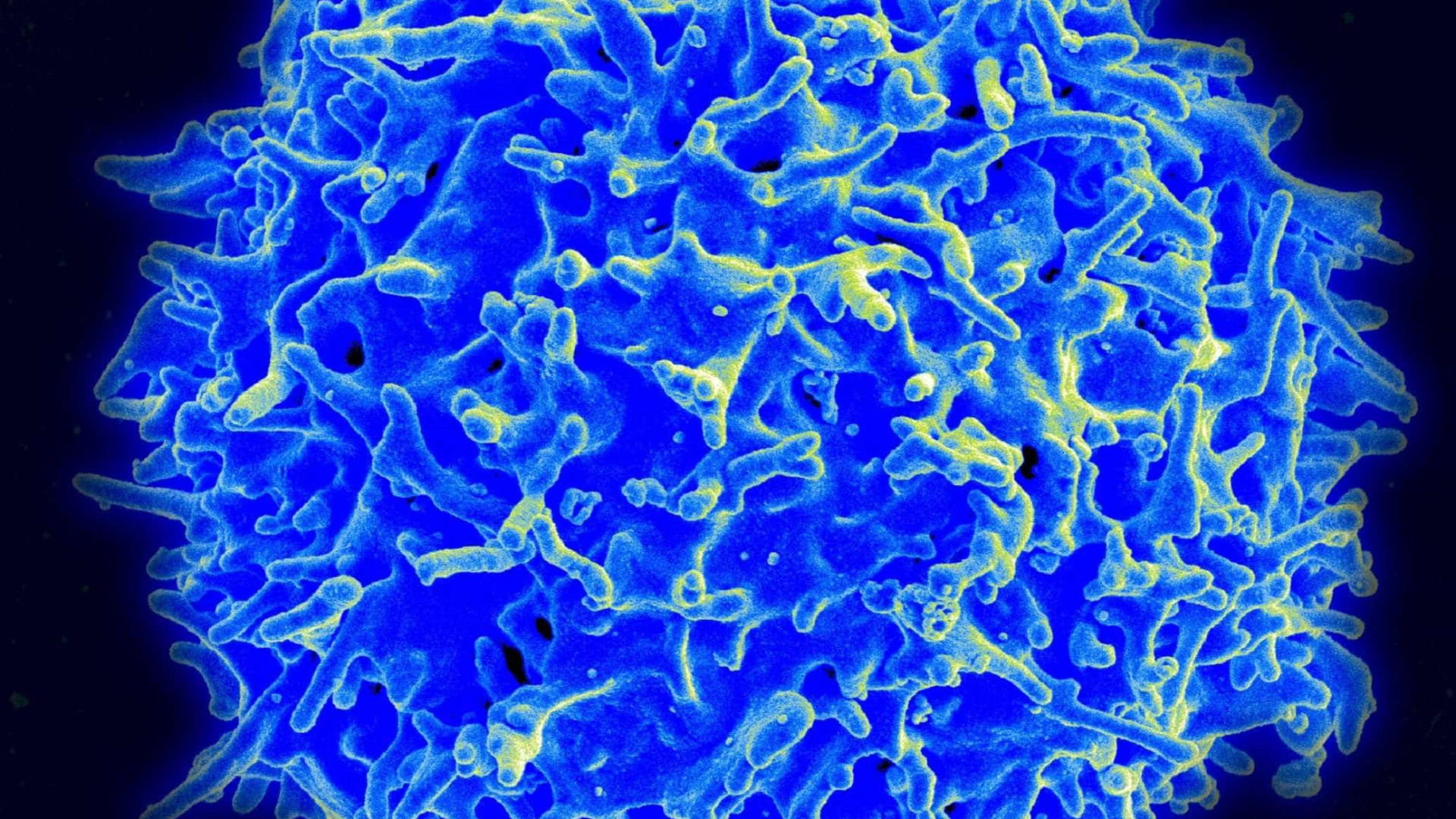 Nova terapia genética consegue remissão da leucemia, aponta estudo