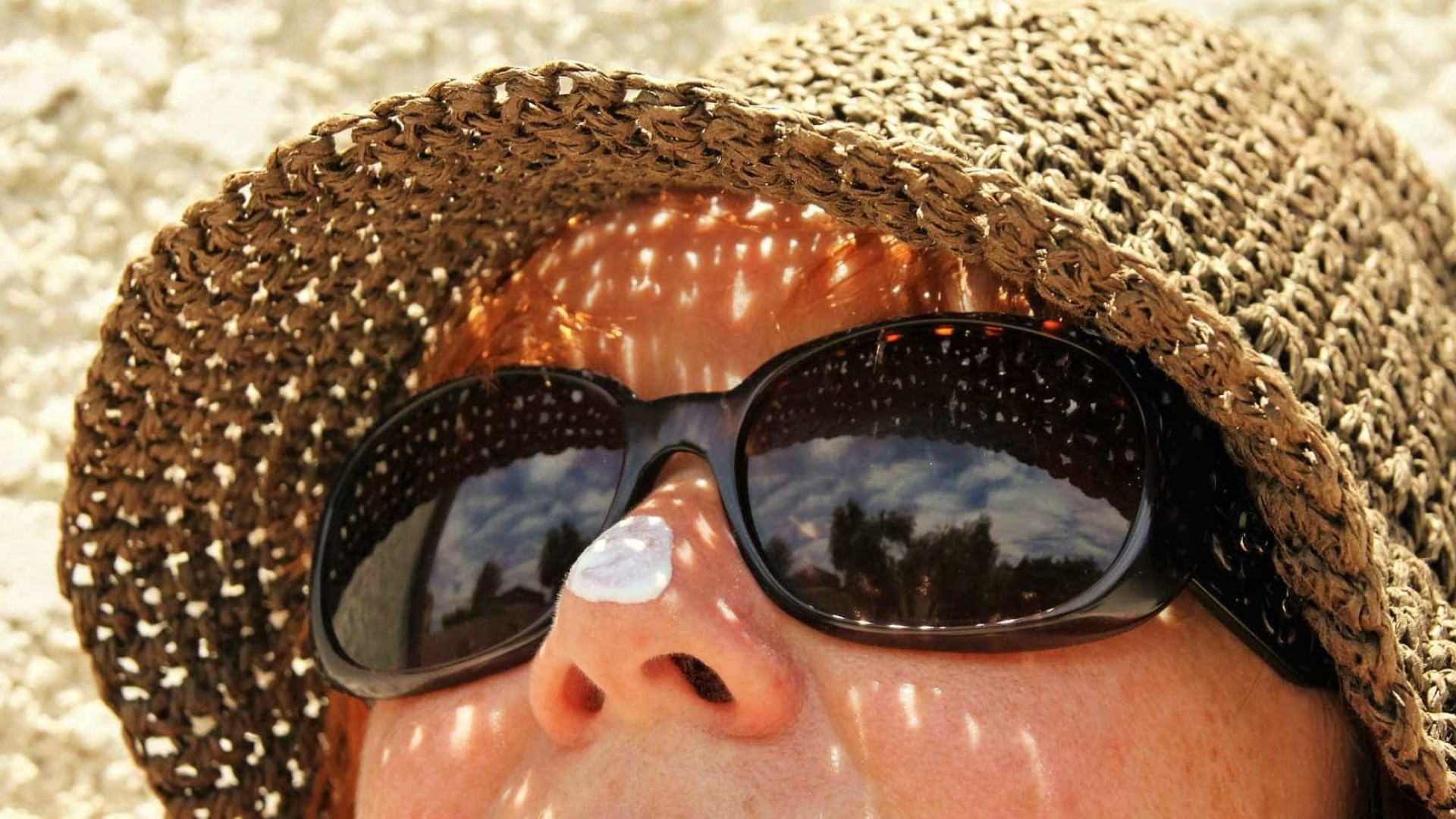 Tudo que você precisa saber antes do verão para evitar danos solares