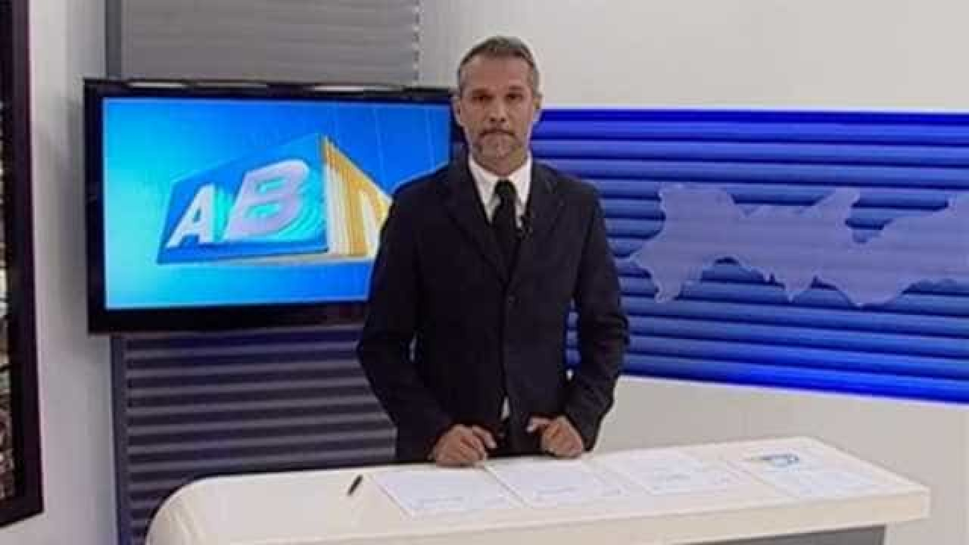 Vítima de bala perdida, apresentador da Globo está em coma induzido