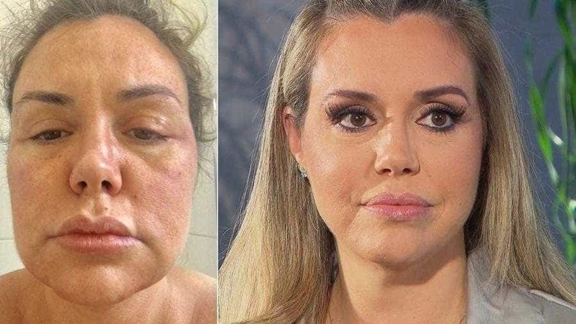 Renata Banhara desabafa: 'Tenho vontade de me suicidar de dor'