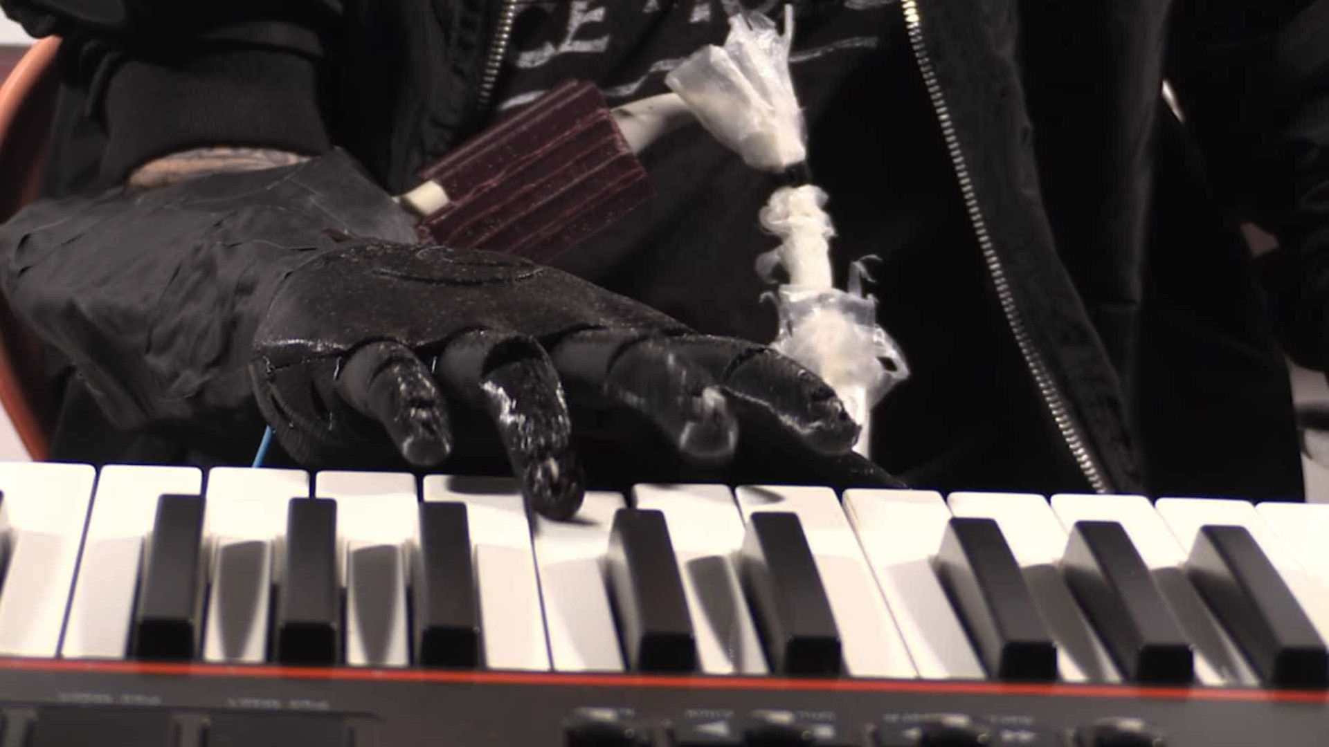 Prótese robótica permite que músico volte a tocar piano