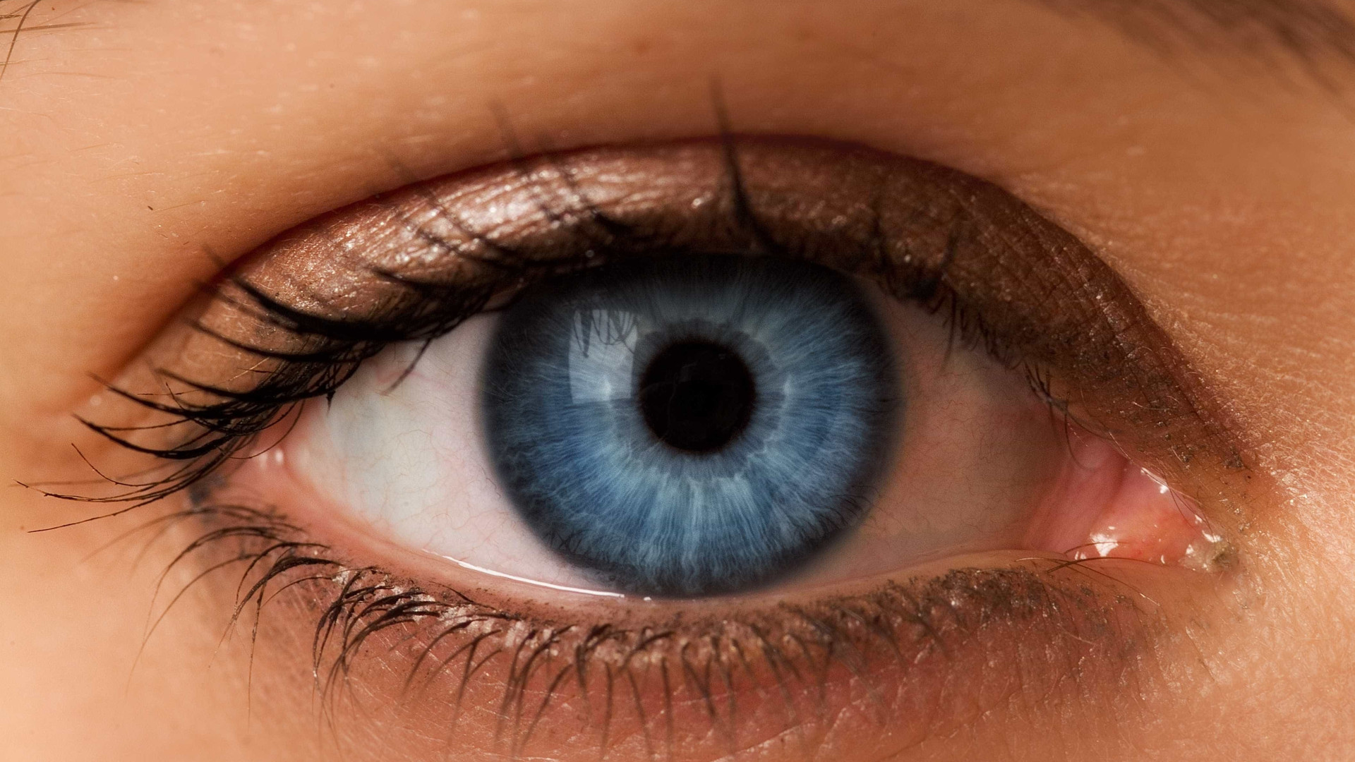 Excesso de remela nos olhos pode indicar problemas