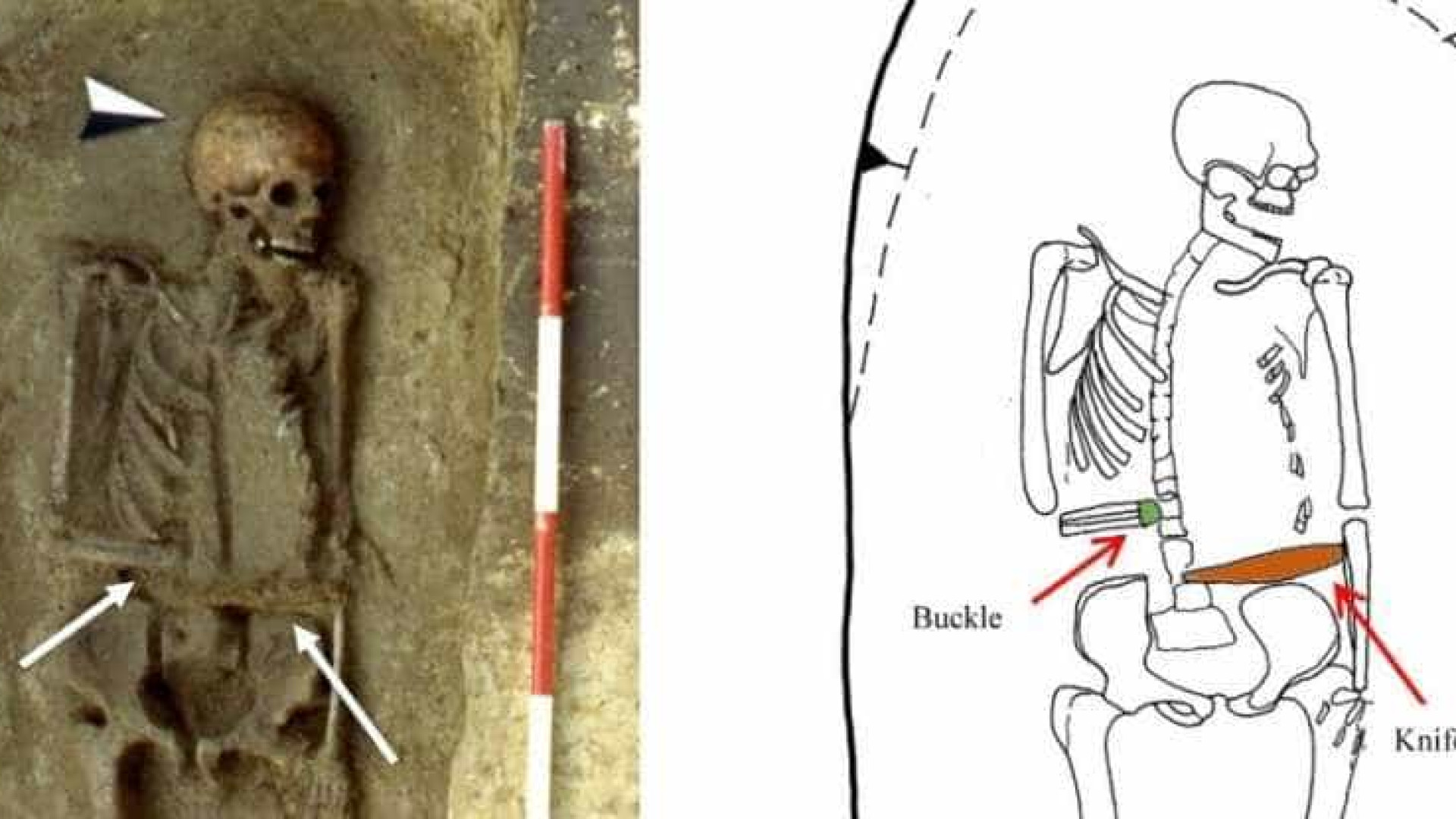 Faca em vez de mão: 'ciborgue' medieval é encontrado na Itália