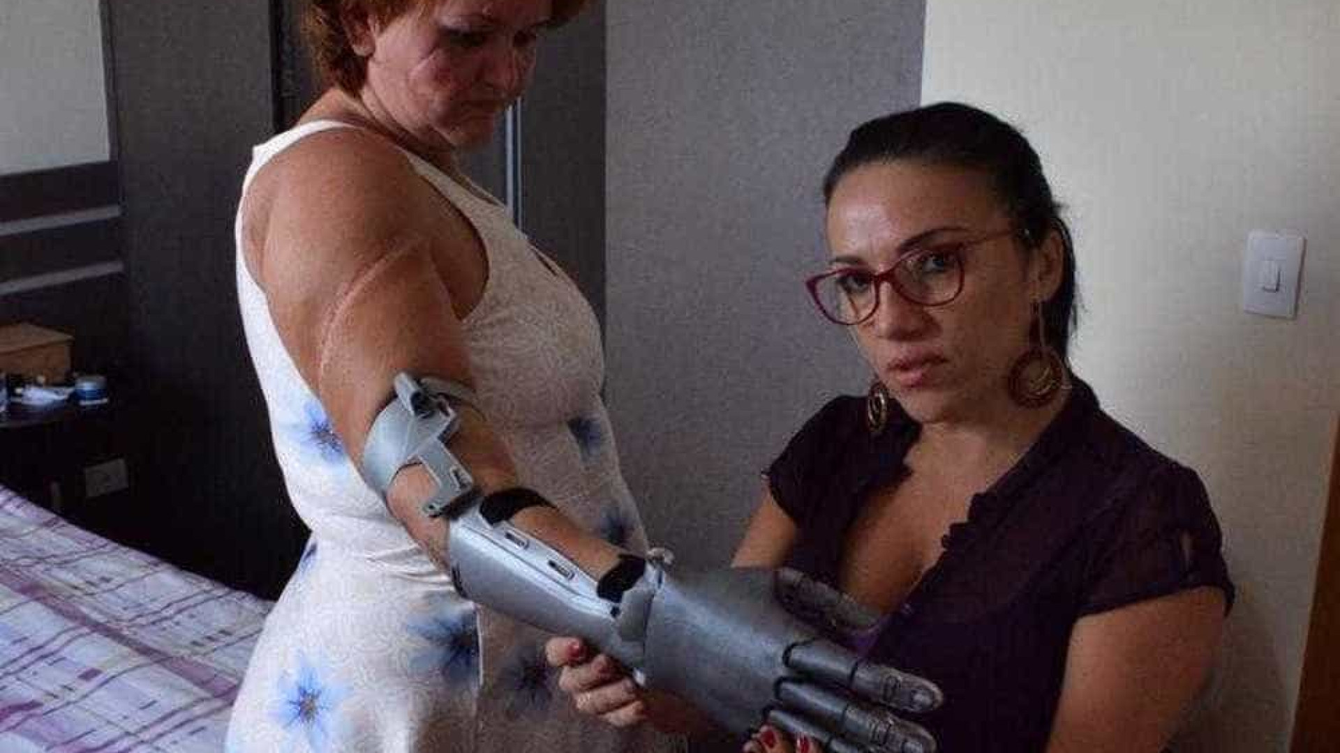 Mulher que teve as mãos decepadas faz campanha para comprar prótese