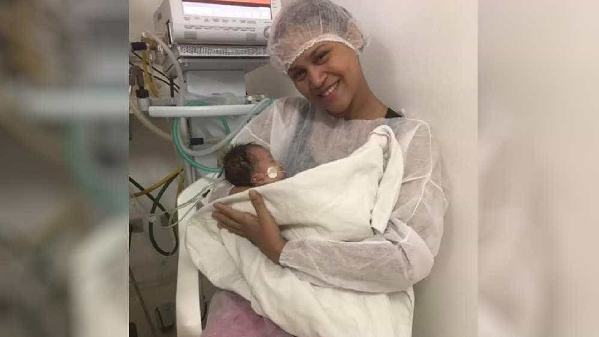 Uma das gêmeas siamesas separadas em Goiânia recebe alta médica