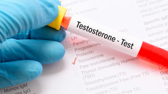 Entenda as funções da testosterona no organismo feminino