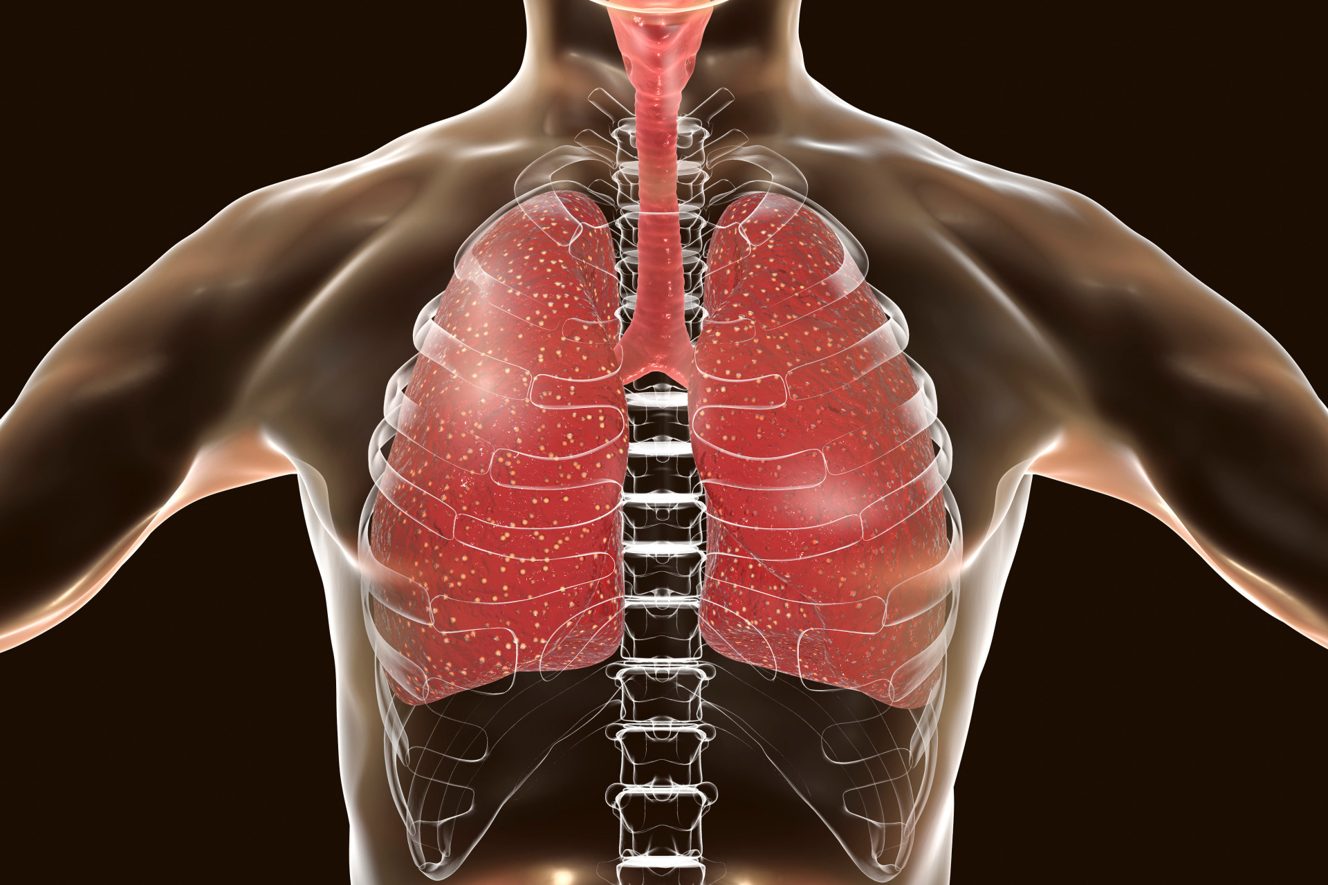 Respire aliviado: conheça as doenças respiratórias e saiba como tratar