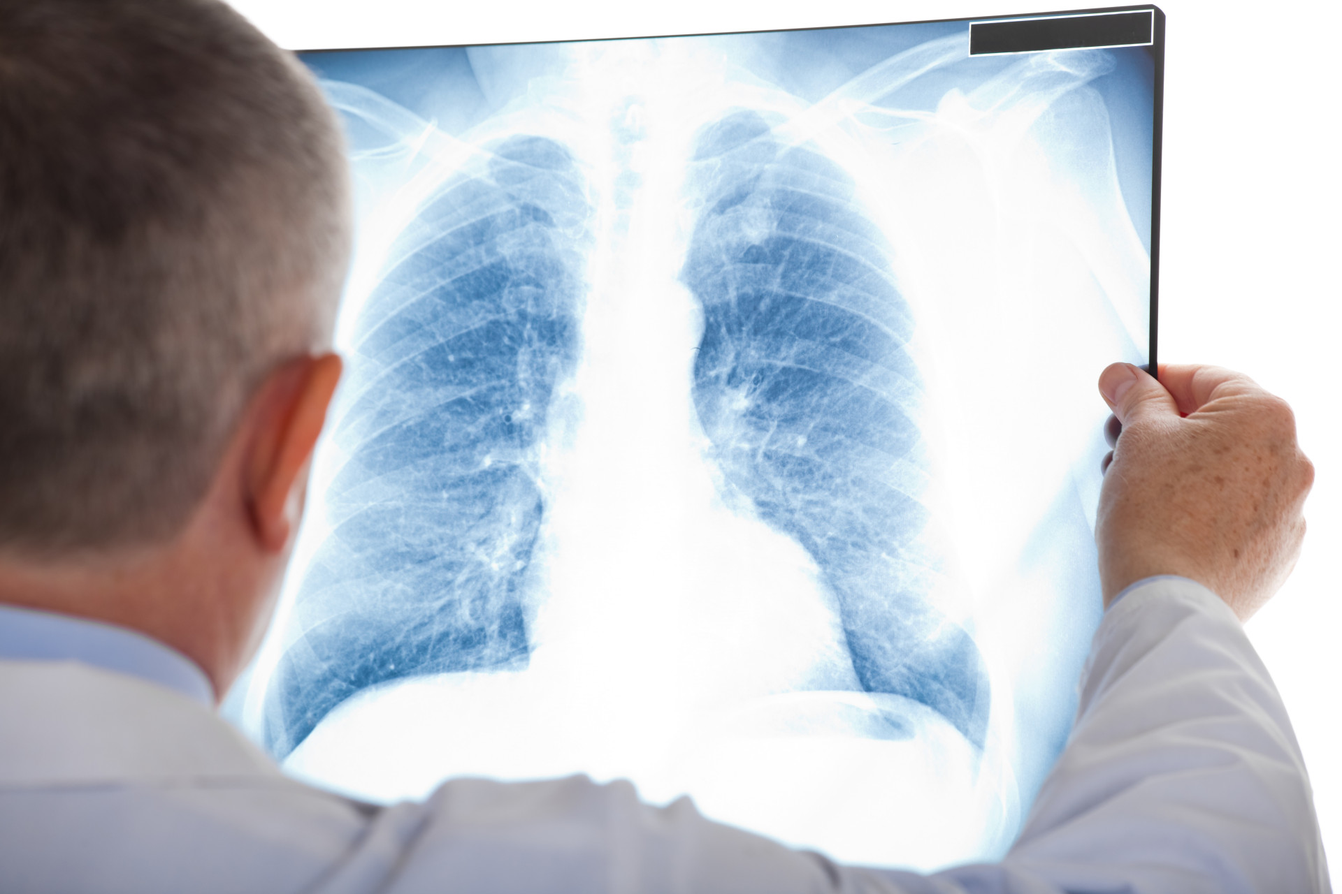 Respire aliviado: conheça as doenças respiratórias e saiba como tratar