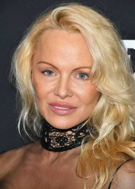 Pamela Anderson aparece irreconhecível após operação plástica